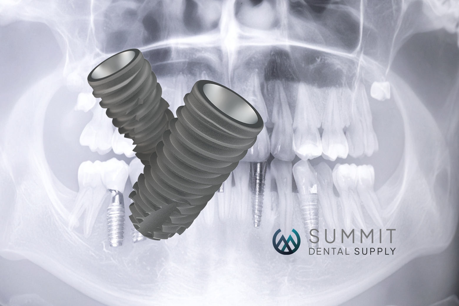 From Extraction to Torque: The GP’s Step-By-Step Playbook for Bullet-Proof Dental Implants
